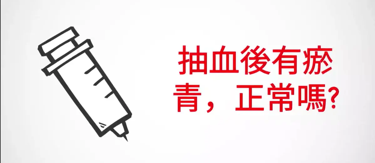 抽血後有瘀青，正常嗎