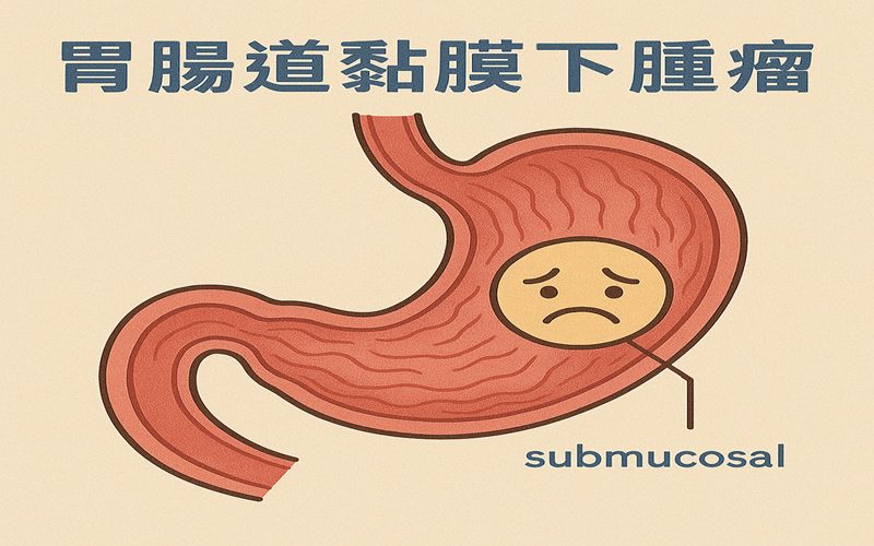 胃腸道黏膜下腫瘤800-500