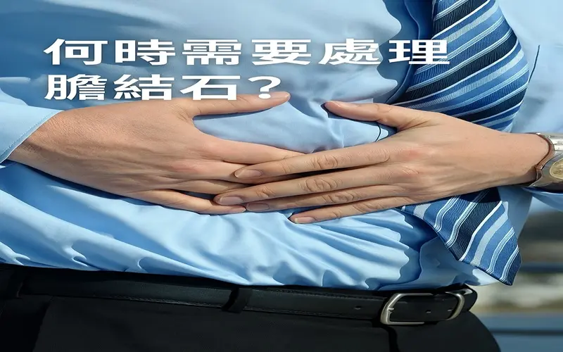 何時需要處理膽結石800-500