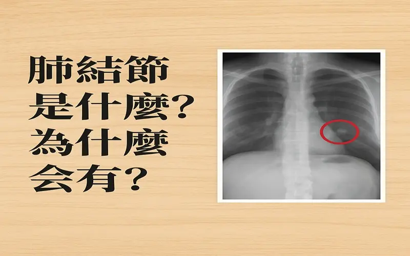 肺結節是什麼-為什麼會有