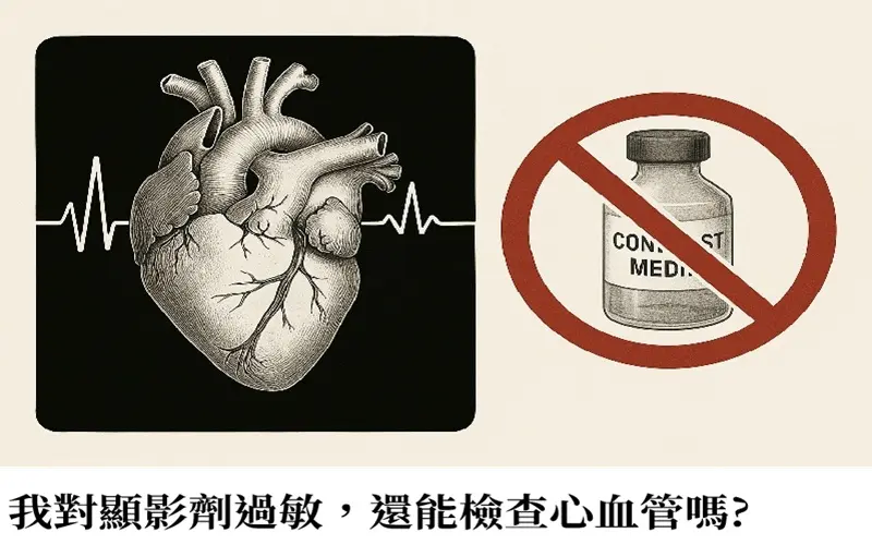 我對顯影劑過敏還能檢查心血管嗎
