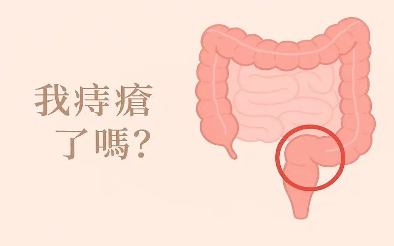 我痔瘡了嗎