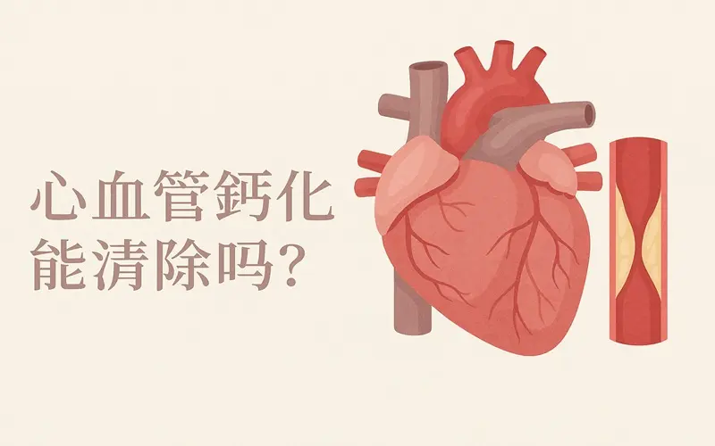 血管鈣化能清除嗎