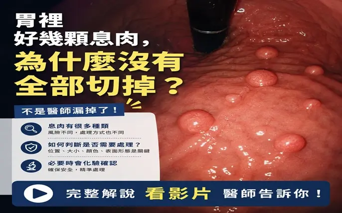 -我 胃 裡 有 好 幾 顆 息 肉 ， 為 什 麼 沒 有 切 掉 ？